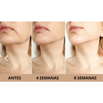 Masajeador 3 en 1 Facial - MASAJEADOR